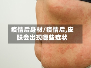 疫情后身材/疫情后,皮肤会出现哪些症状-第1张图片