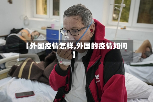 【外国疫情怎样,外国的疫情如何】-第1张图片