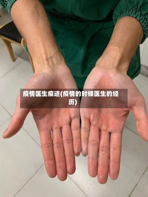 疫情医生痕迹(疫情的时候医生的经历)-第2张图片