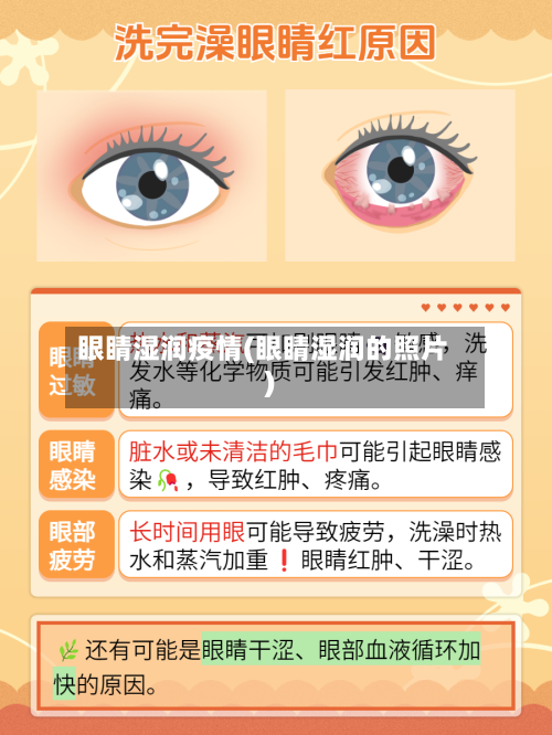 眼睛湿润疫情(眼睛湿润的照片)-第1张图片