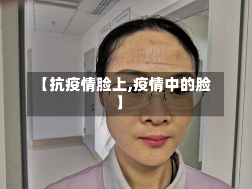 【抗疫情脸上,疫情中的脸】-第2张图片