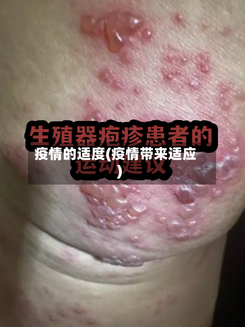 疫情的适度(疫情带来适应)-第1张图片