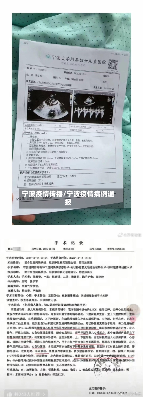 宁波疫情传播/宁波疫情病例通报-第1张图片