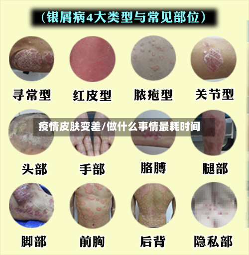 疫情皮肤变差/做什么事情最耗时间-第2张图片