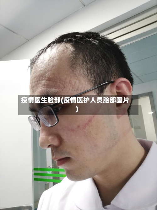 疫情医生脸部(疫情医护人员脸部图片)-第1张图片