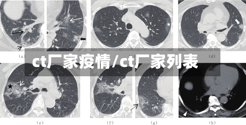 ct厂家疫情/ct厂家列表-第1张图片
