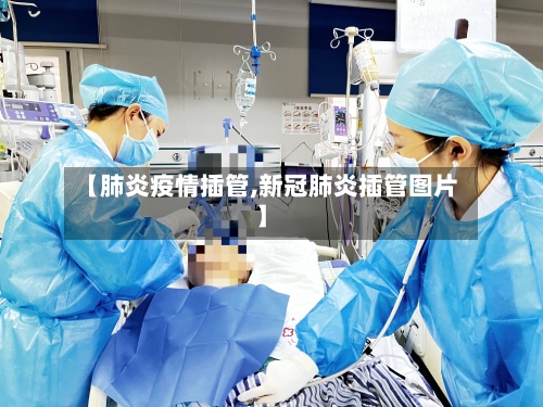 【肺炎疫情插管,新冠肺炎插管图片】-第1张图片