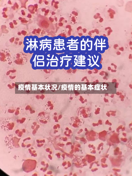 疫情基本状况/疫情的基本症状-第1张图片