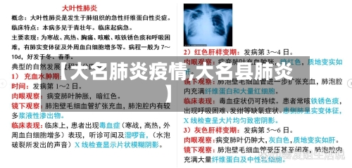 【大名肺炎疫情,大名县肺炎】-第1张图片