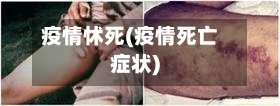 疫情怵死(疫情死亡症状)-第2张图片
