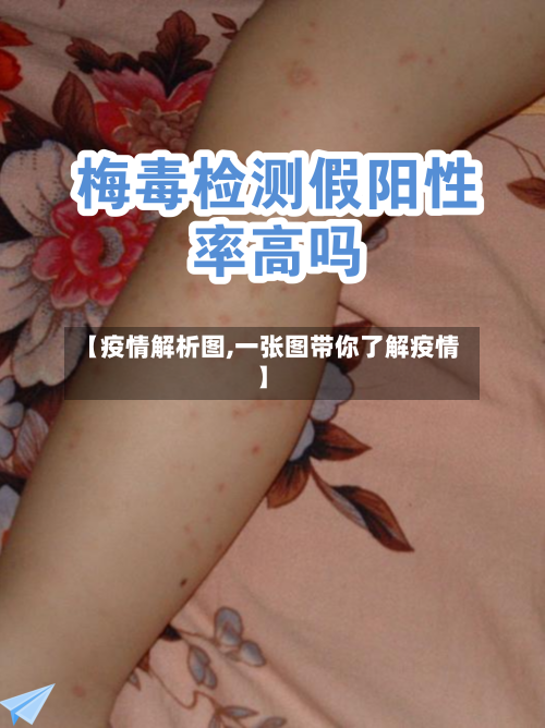 【疫情解析图,一张图带你了解疫情】-第1张图片