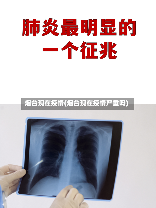 烟台现在疫情(烟台现在疫情严重吗)-第2张图片