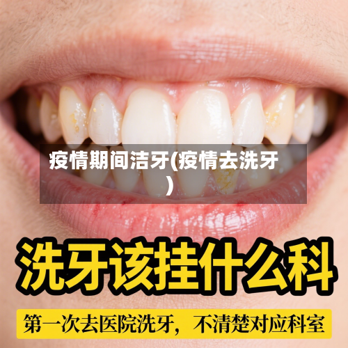 疫情期间洁牙(疫情去洗牙)-第1张图片