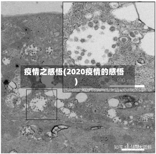 疫情之感悟(2020疫情的感悟)-第2张图片