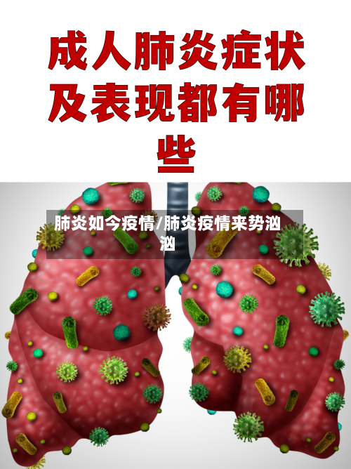 肺炎如今疫情/肺炎疫情来势汹汹-第2张图片