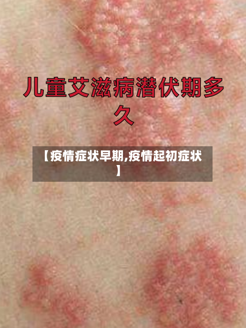 【疫情症状早期,疫情起初症状】-第2张图片