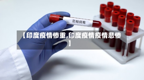 【印度疫情惨重,印度疫情疫情悲惨】-第3张图片