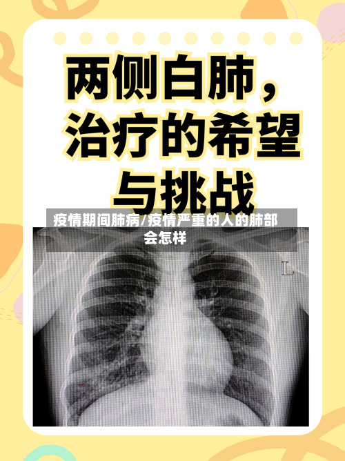 疫情期间肺病/疫情严重的人的肺部会怎样-第1张图片