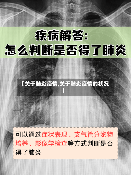 【关于肺炎疫情,关于肺炎疫情的状况】-第2张图片