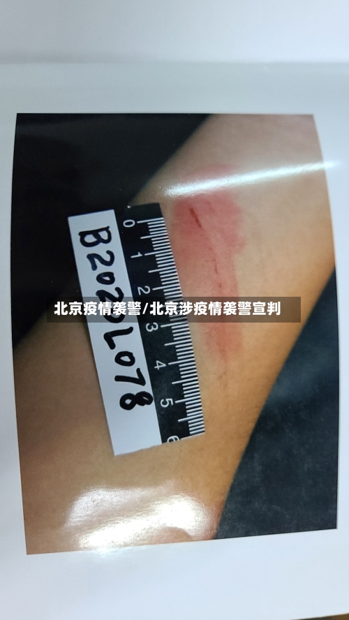 北京疫情袭警/北京涉疫情袭警宣判-第2张图片