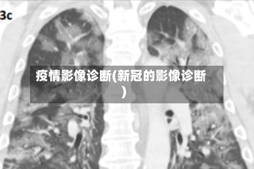 疫情影像诊断(新冠的影像诊断)-第1张图片
