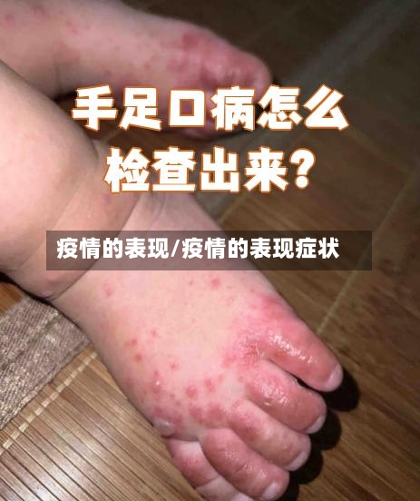 疫情的表现/疫情的表现症状-第2张图片