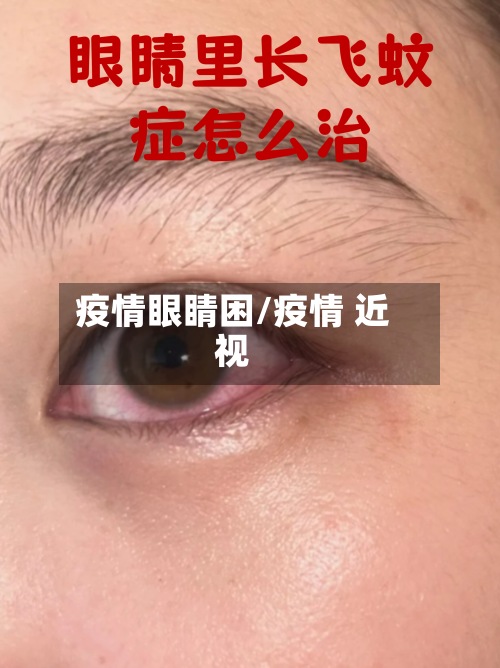疫情眼睛困/疫情 近视-第1张图片